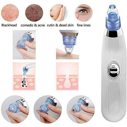 Derma Suction Vacuum Pore Cleanser